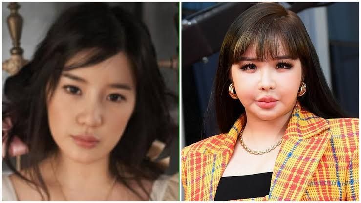 Salah satu artis korea yang gagal dalam operasi wajah, di ketahui seorang mantan anggota 2NE1